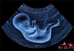 北京找捐卵妹，北京治疗卵巢早衰医院有哪些